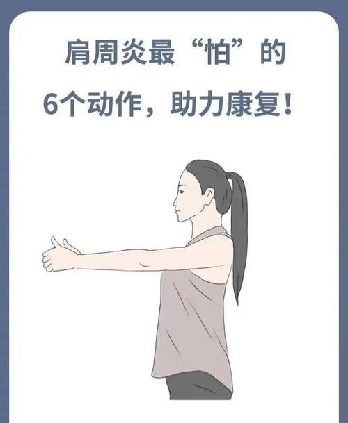 解决风湿性肩周炎方法