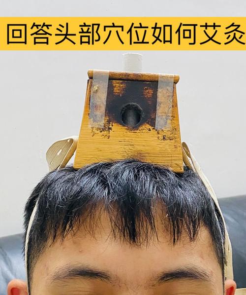 头上可以艾灸的穴位