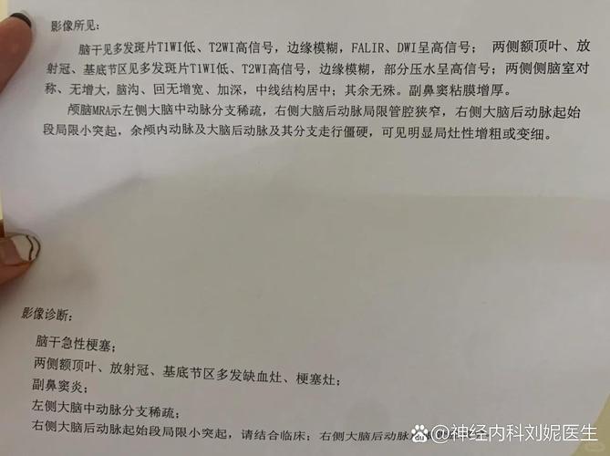 吃鸡蛋对脑梗有影响么