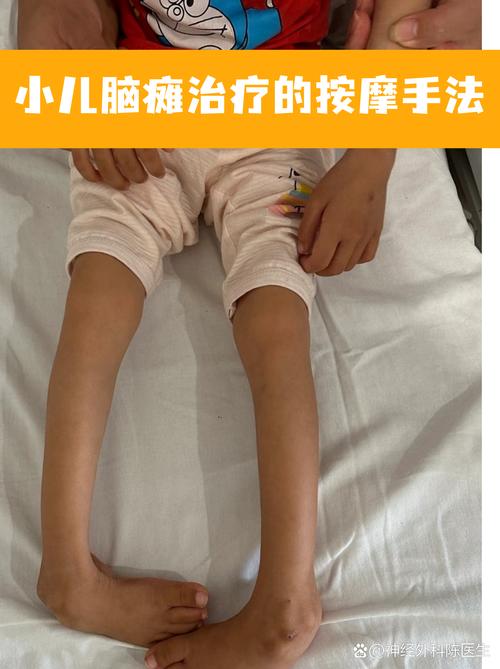 脑梗造成手抖如何恢复