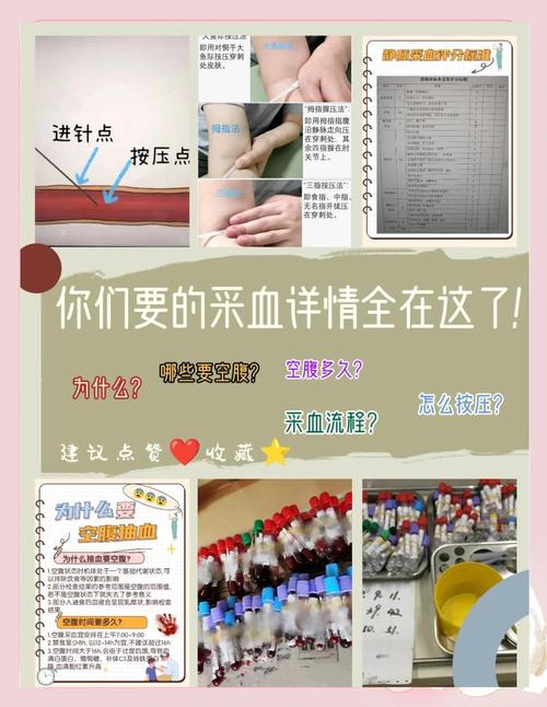 内风湿查血需要空腹吗