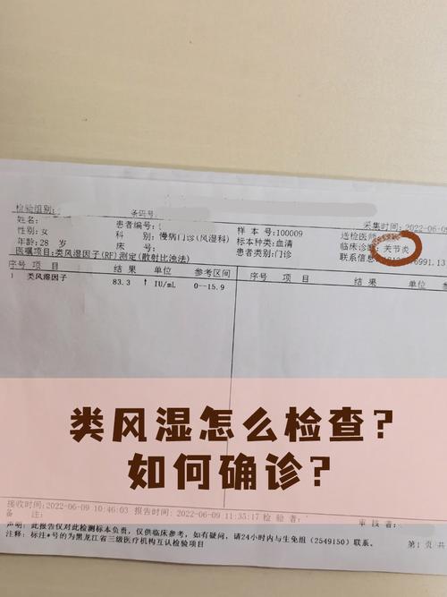 做什么检查能确诊风湿