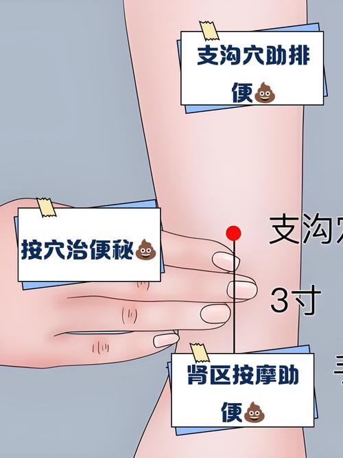 治疗肠道炎症的穴位