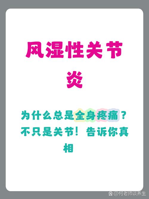 全身肌肉酸痛是风湿吗