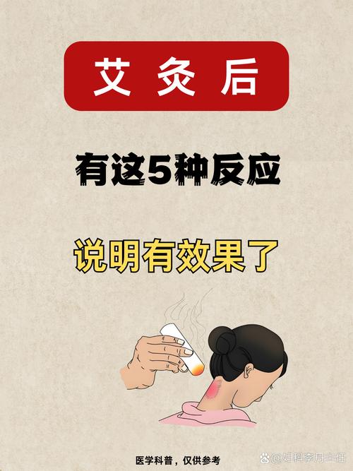 艾灸可治疗产后风湿吗