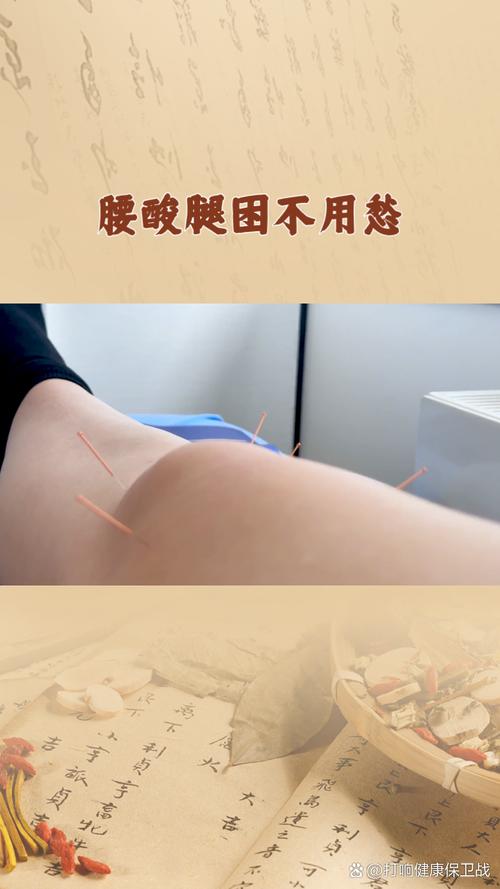 下肢水肿针灸的穴位