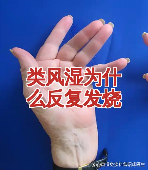 为什么类风湿晚上加重