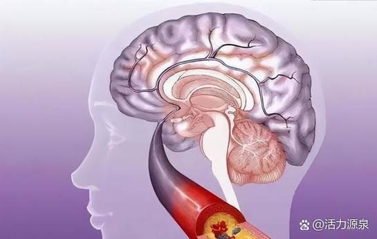 老年人有点脑梗正常吗