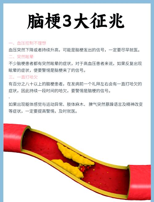 怎样预防脑血栓和脑梗