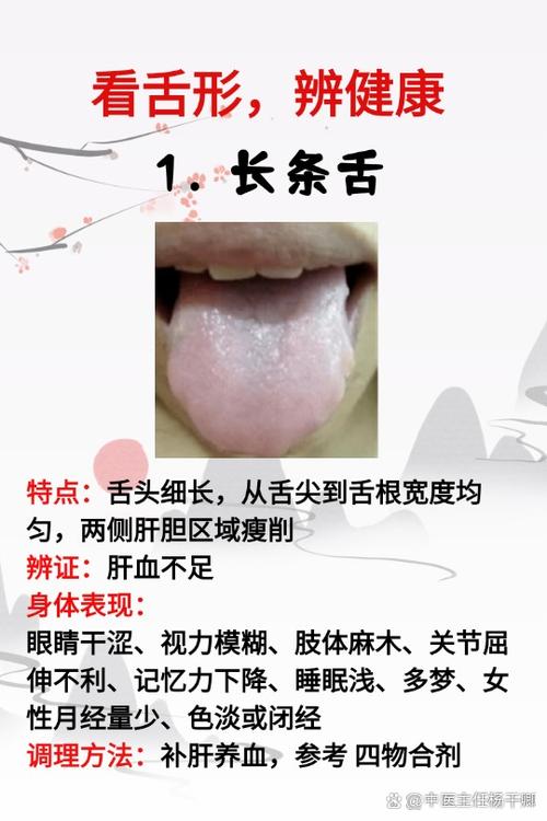 如何判断脑梗的大舌头