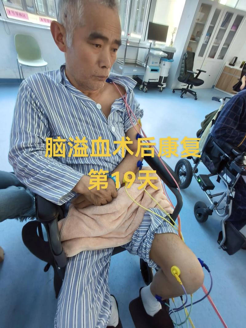 脑梗后多久可以做手术