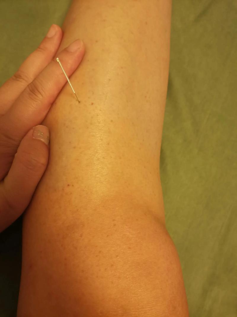 脚跟补疼痛针灸穴位