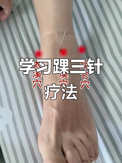 脚跟补疼痛针灸穴位