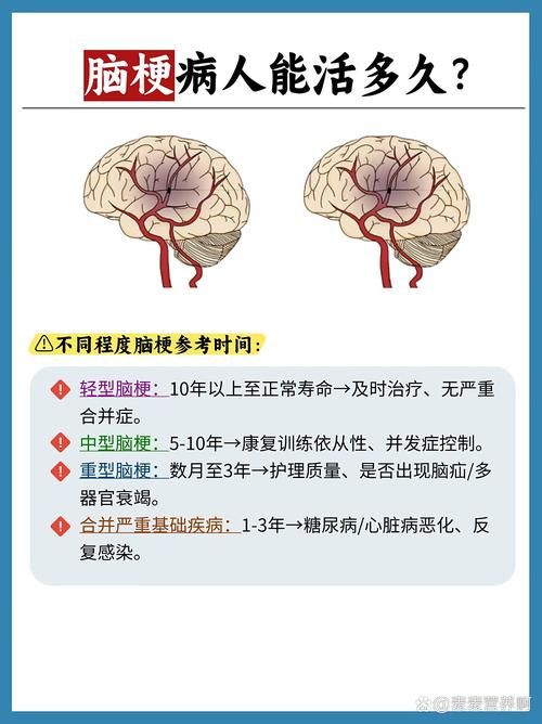 脑梗鼻饲最长能活几年