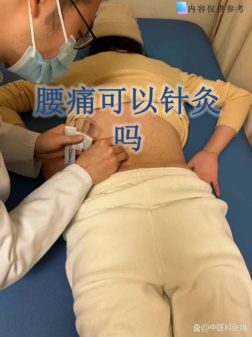 产后风湿针灸能治好吗