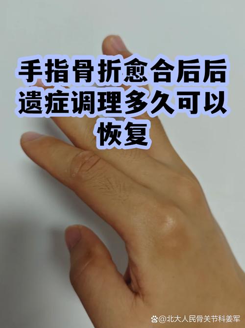 类风湿骨折后多久愈合