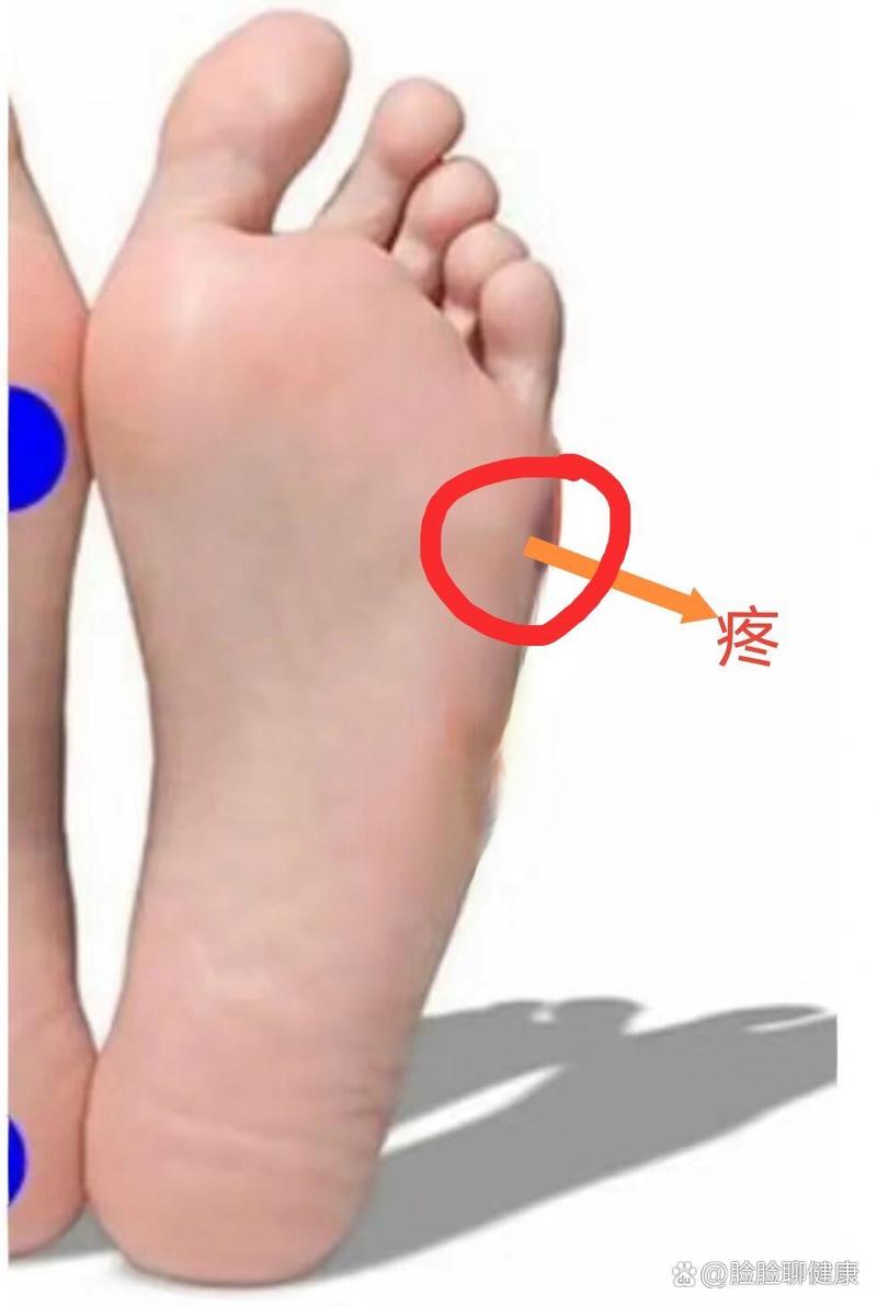 脚上小拇指外侧穴位