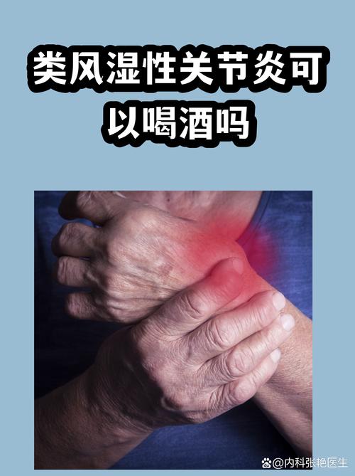 类风湿患者可以喝酒吗