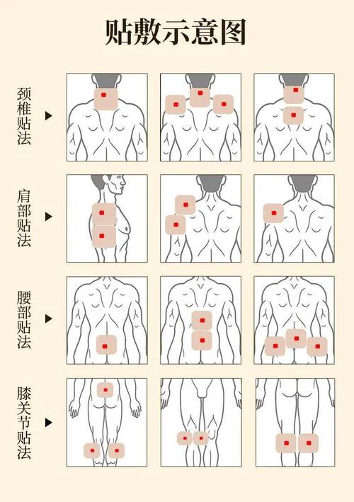 风湿背部疼痛怎么治疗