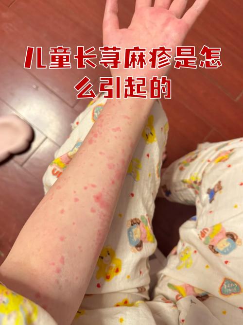 小孩风湿是怎么引起的