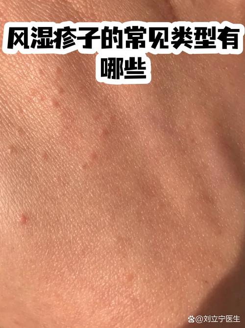 过敏免疫风湿科是什么