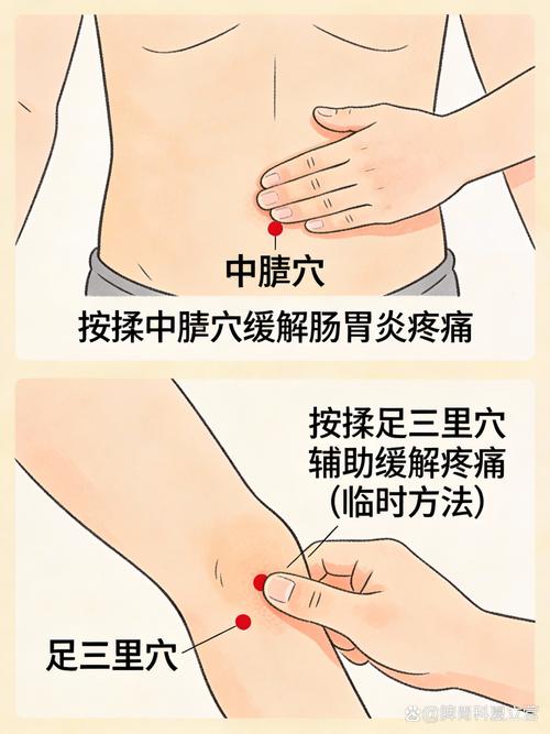 萎缩胃炎的穴位疗法