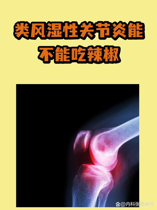 类风湿患者可以减肥吗