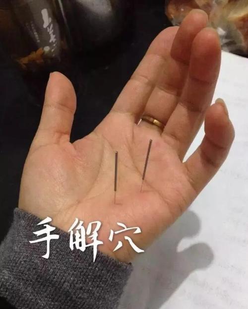 哪个穴位治手部痛风