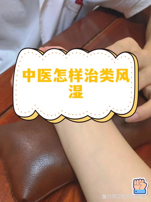 武城那有看风湿的中医