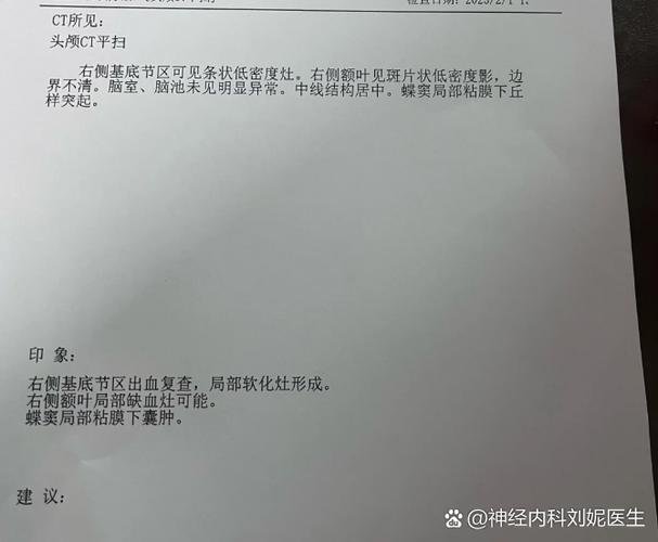 脑梗软化灶是什么意思