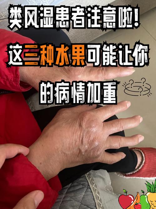 风湿有什么水果不能吃