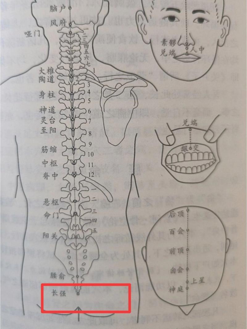 长强穴位坐着有点涨