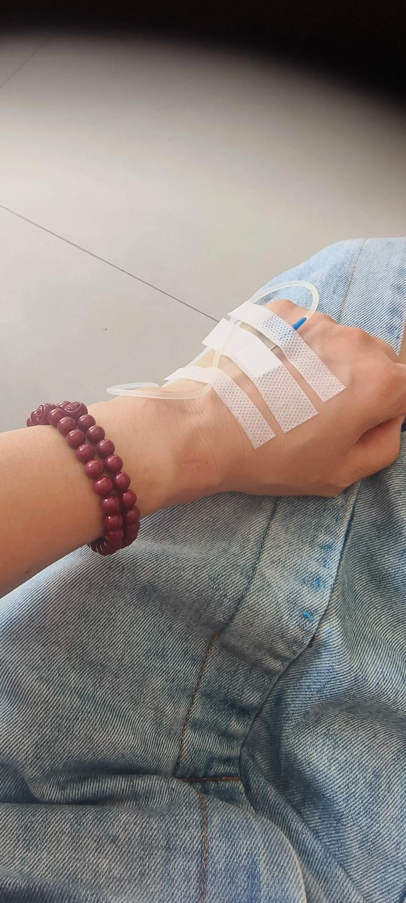 类风湿输液的效果好吗