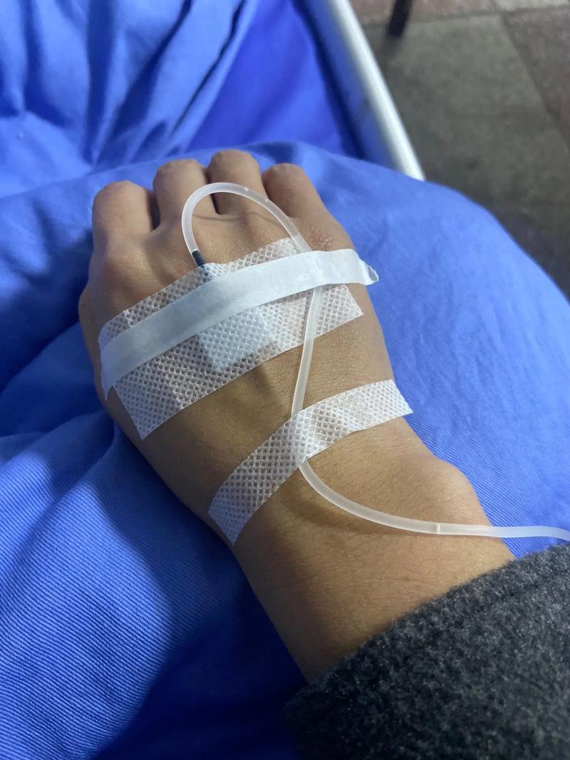 类风湿输液的效果好吗