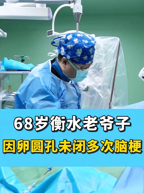 卵圆孔未闭引起的脑梗