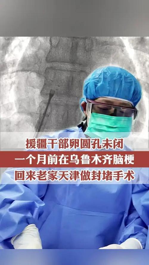 卵圆孔未闭引起的脑梗