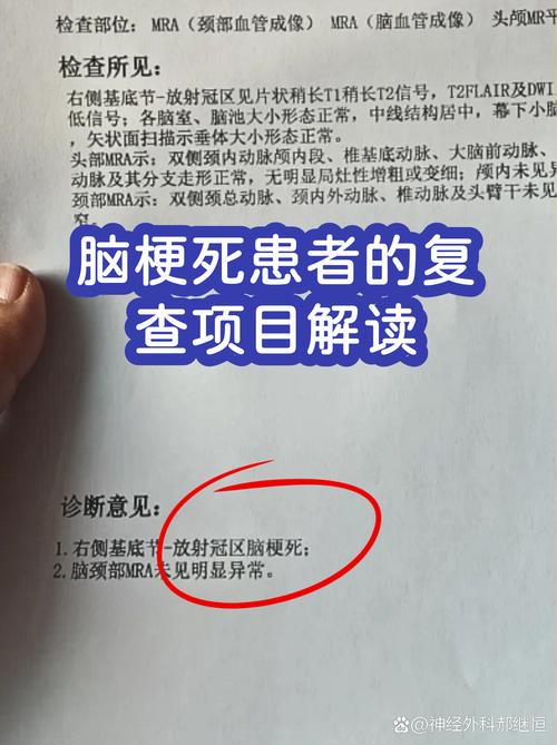 脑梗复查哪些检查项目