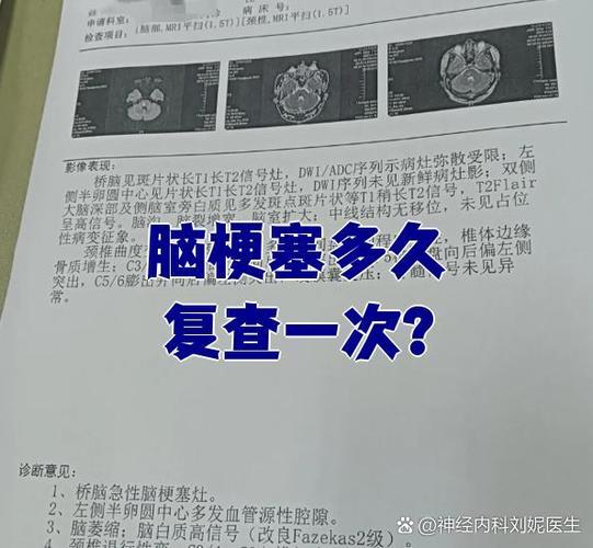 脑梗复查哪些检查项目