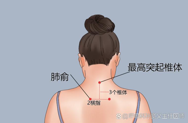 烟雾病按摩哪些穴位