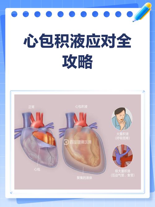 风湿心脏病 心包积液