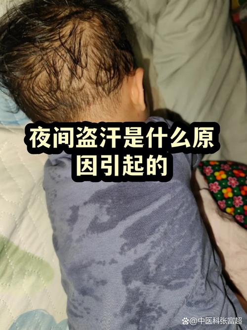 小腿风湿晚上睡觉出汗