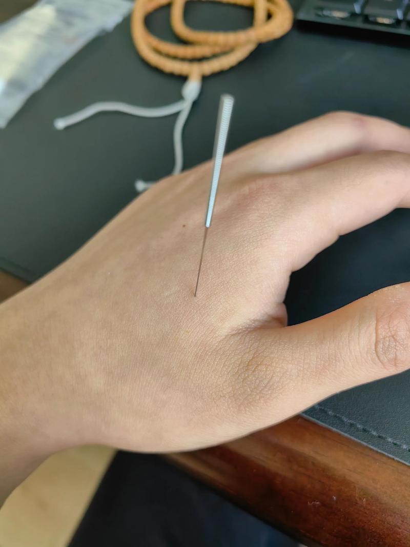 初学针灸扎哪些穴位