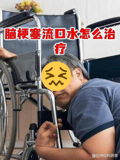 脑梗流口水是怎么回事