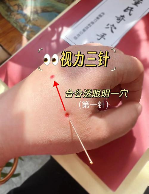 治疗宝宝挤眼的穴位