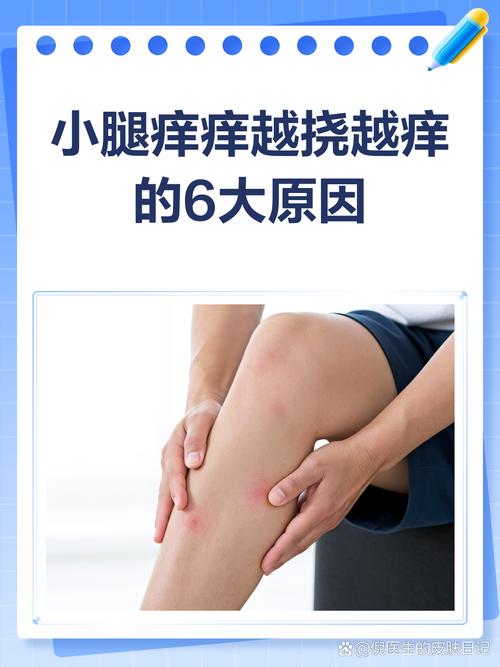 小腿外侧怕冷是风湿吗