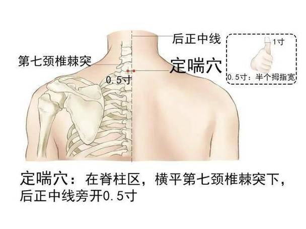 谷世喆 哮喘 穴位