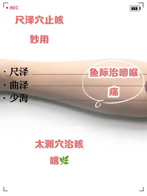 谷世喆 哮喘 穴位