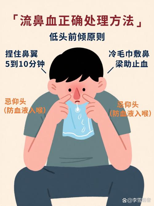 脑梗病人流鼻血是好事