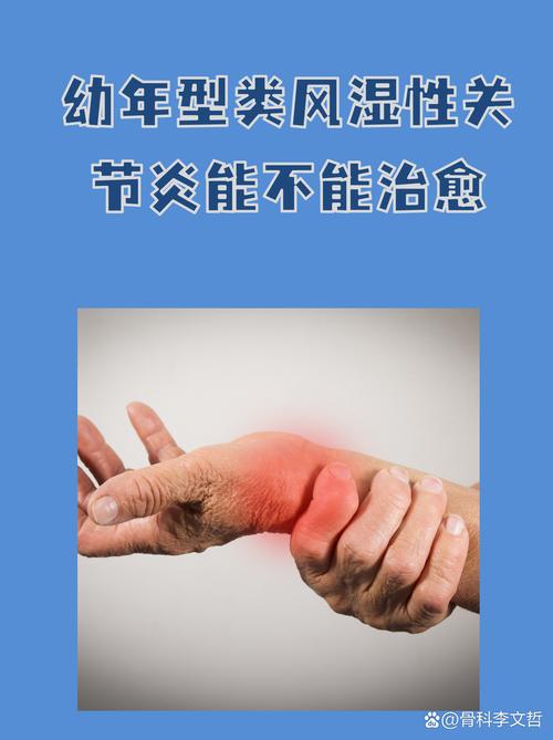 长春田氏骨病风湿专科