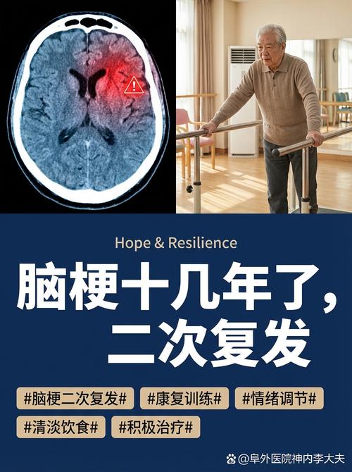 脑梗几年不复发就好了